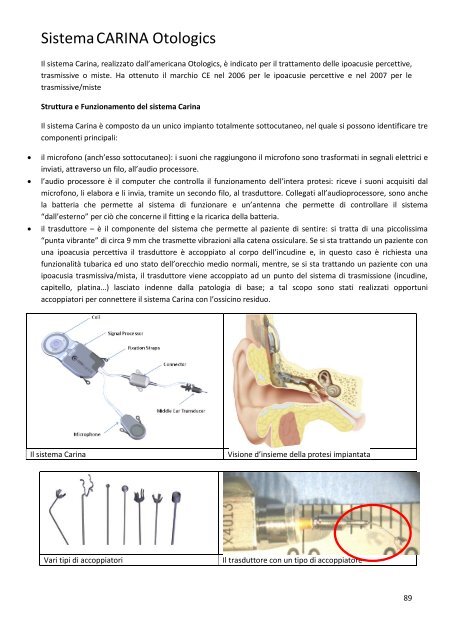 Sistema CARINA Otologics - Otologia Bologna