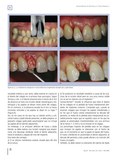 Estética de los tejidos blandos periimplantarios. - COEM