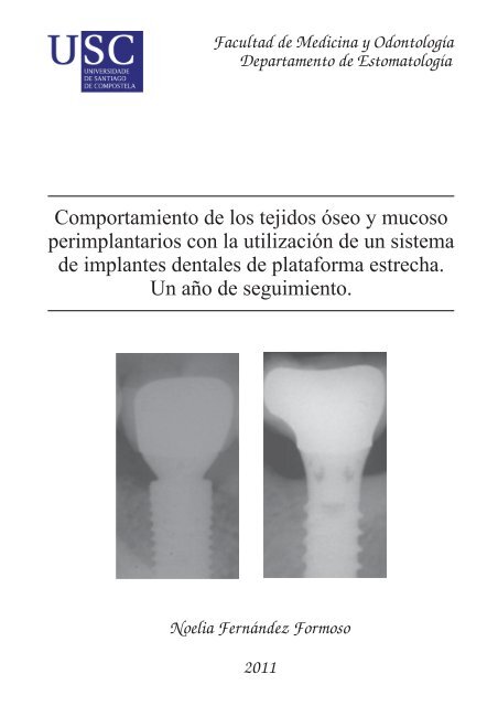 Comportamiento de los tejidos óseo y mucoso perimplantarios con ...