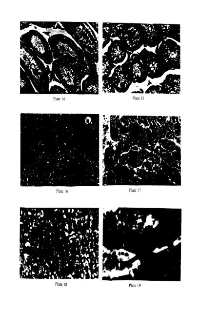 effect of infection of the filarial parasite brugia malayi - Pondicherry ...