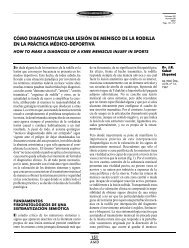 Cómo diagnosticar una lesión de menisco de la rodilla en ... - Femede