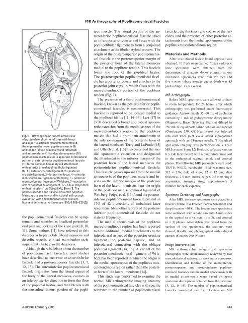 Popliteomeniscal Fascicles: Anatomic Considerations Using MR ...