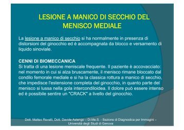 lesione a manico di secchio del menisco mediale - Sezione di ...