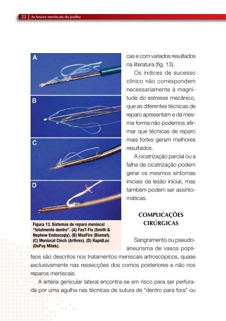 atualização em ortopedia e traumatologia do esporte ... - SBRATE