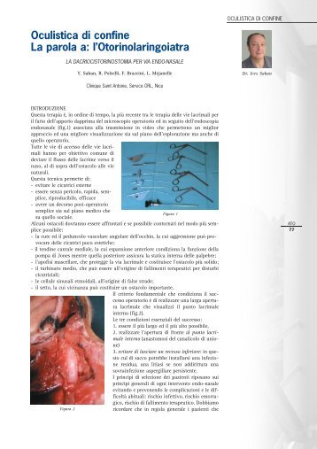 La dacriocistorinostomia per via endo-nasale - Farmigea