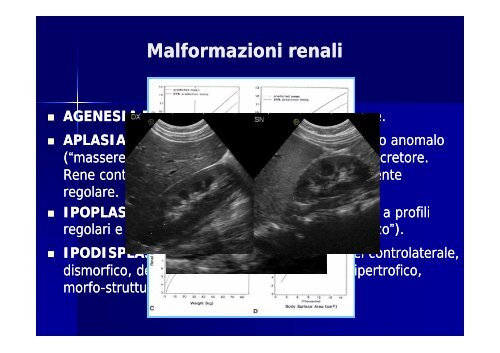 Il ruolo dell'ecografia nella gestione delle uropatie malformative - Fimp