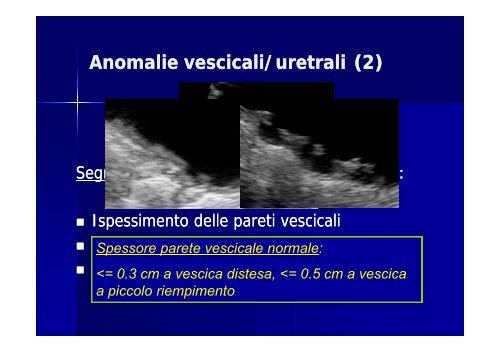 Il ruolo dell'ecografia nella gestione delle uropatie malformative - Fimp