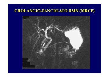 CHOLANGIO-PANCREATO RMN (MRCP) - medicaldivision