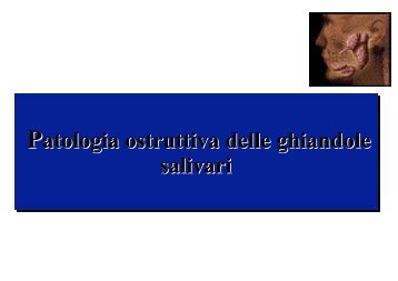 Patologia ostruttiva delle ghiandole salivari ... - Clinica pediatrica