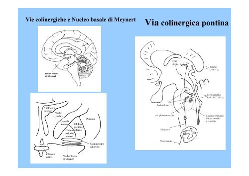 La demenza nel Parkinson e nei Parkinsonismi - Onofrj, Marco