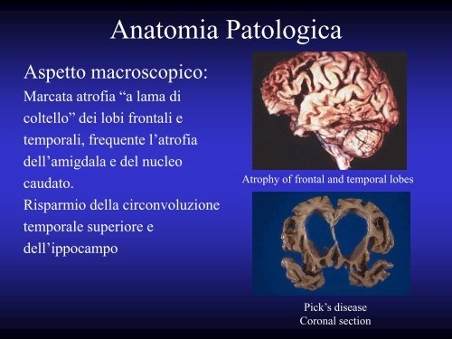 Le Demenze - Università degli Studi di Perugia