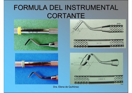 Instrumental Cortante de Mano para Odontología Operatoria