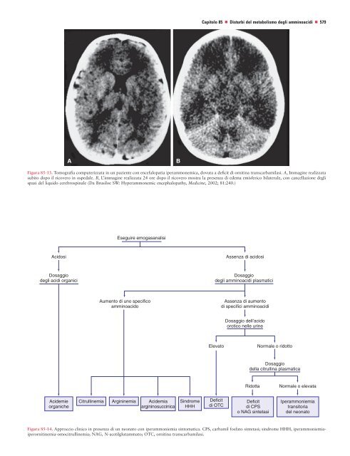 Capitolo 85 Disturbi del metabolismo degli amminoacidi - Doctor33