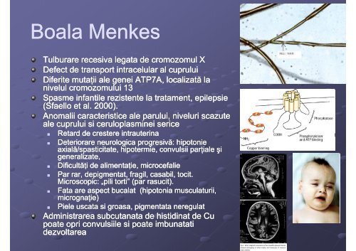 epilepsia in boli metabolice [Compatibility Mode]