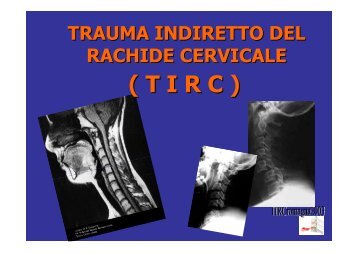 trauma cervicale.pdf - Infermieristica Rimini