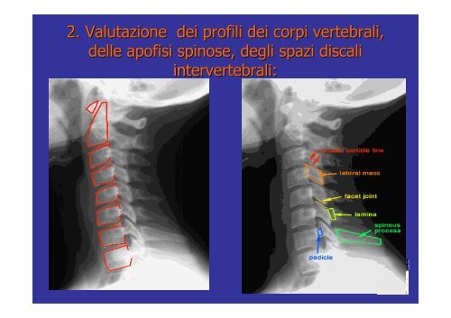 trauma cervicale.pdf - Infermieristica Rimini