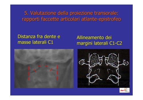 trauma cervicale.pdf - Infermieristica Rimini