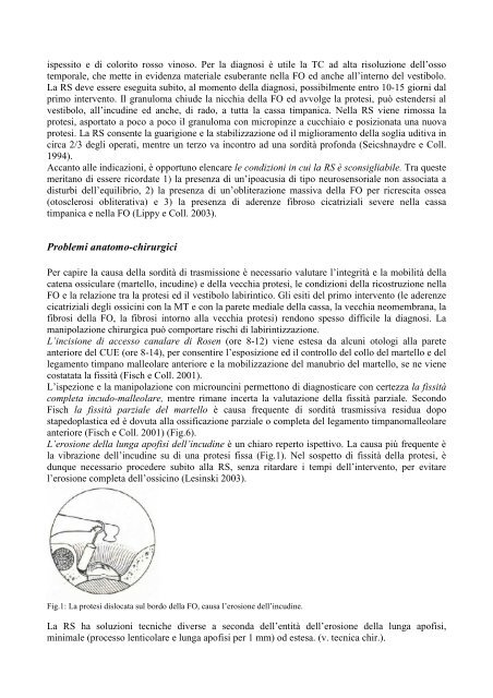 La chirurgia di revisione di stapedoplastica. - Orlpisa.It