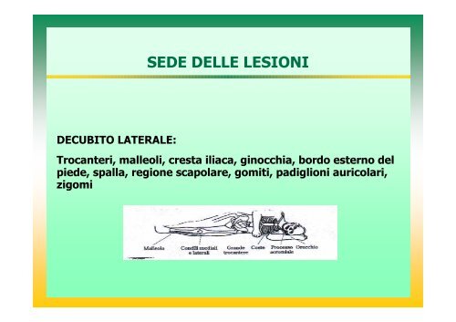 l'infermiere nella prevenzione e nel trattamento delle lesioni da ...