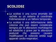 scoliosi