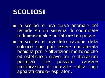scoliosi