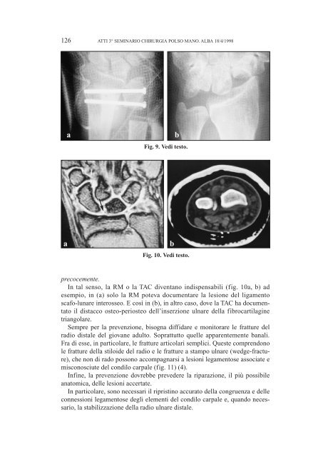 ATTI 3° SEMINARIO SULL'INSTABILITA' CARPALE (Aprile 1998)