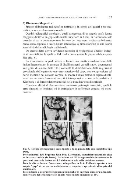 ATTI 3° SEMINARIO SULL'INSTABILITA' CARPALE (Aprile 1998)