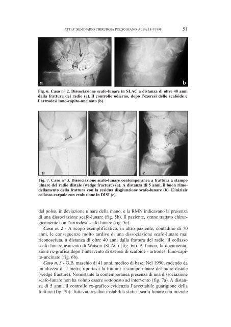 ATTI 3° SEMINARIO SULL'INSTABILITA' CARPALE (Aprile 1998)