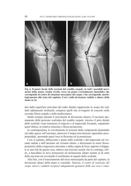 ATTI 3° SEMINARIO SULL'INSTABILITA' CARPALE (Aprile 1998)