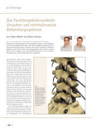 Das Facettengelenkssyndrom: Ursachen und minimalinvasive ...