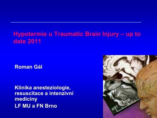 Hypotermie u TBI – up to date 2011 - Česká společnost ...