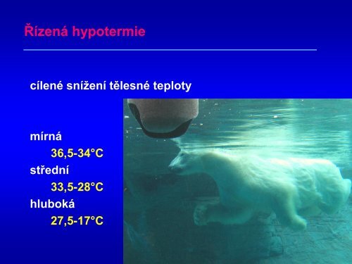 Hypotermie u TBI – up to date 2011 - Česká společnost ...