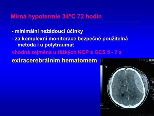 Hypotermie u TBI – up to date 2011 - Česká společnost ...
