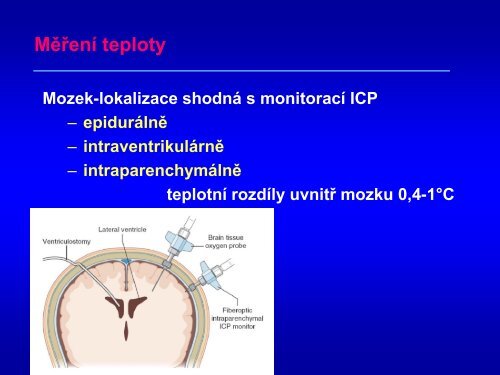 Hypotermie u TBI – up to date 2011 - Česká společnost ...