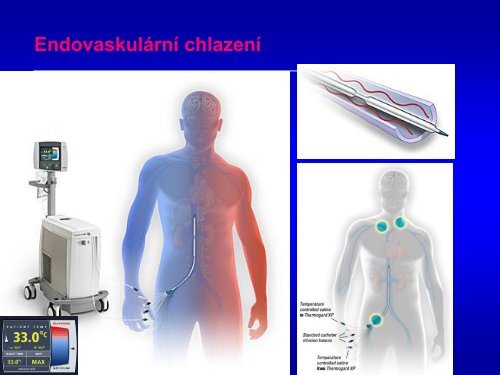 Hypotermie u TBI – up to date 2011 - Česká společnost ...