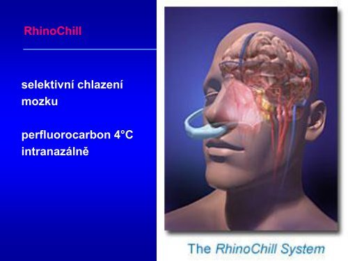 Hypotermie u TBI – up to date 2011 - Česká společnost ...