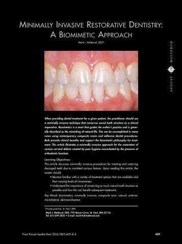 minimally invasive restorative dentistry: a biomimetic ... - Venus
