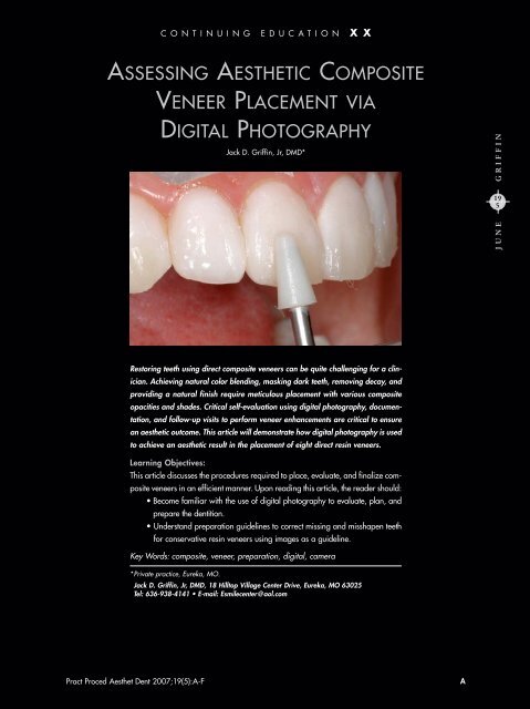 assessing aesthetic composite veneer placement via digital ...