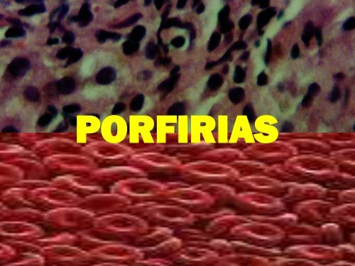 Porfiria parte I