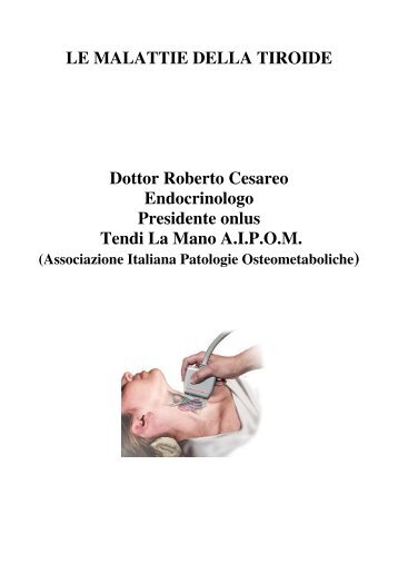 LE MALATTIE DELLA TIROIDE Dottor Roberto Cesareo ...