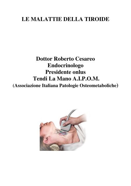 tiroide iodio perdita di pesona