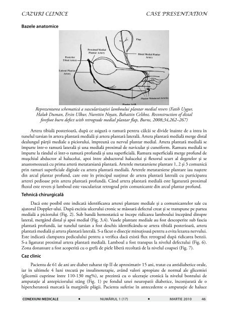 reconstrucţia în piciorul diabetic utilizând lamboul insular plantar ...