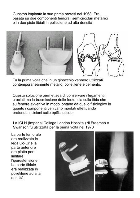 Biomeccanica del ginocchio - Fisiokinesiterapia.biz