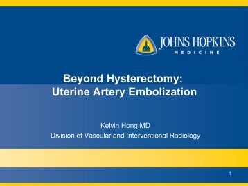 Beyond Hysterectomy: Uterine Artery Embolization - American ...