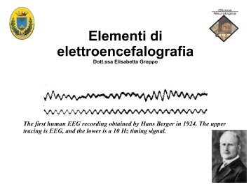 Elementi di elettroencefalografia