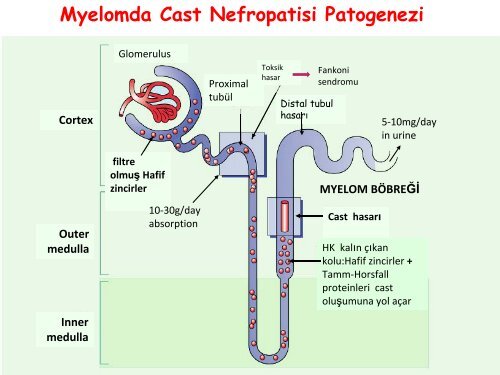 Nefroloji - Lenfoma Myeloma Derneği