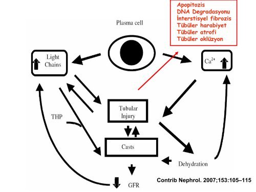 Nefroloji - Lenfoma Myeloma Derneği