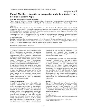 Fungal Maxillary sinusitis - Kathmandu University Medical Journal ...