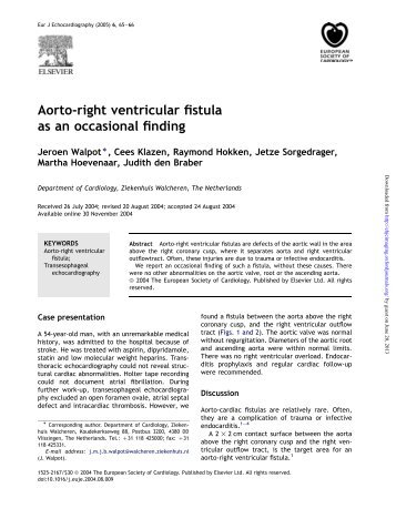 Aorto-right ventricular fistula as an occasional finding - EHJ ...