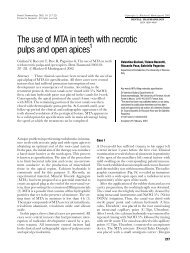 The use of MTA in teeth with necrotic pulps and open apices